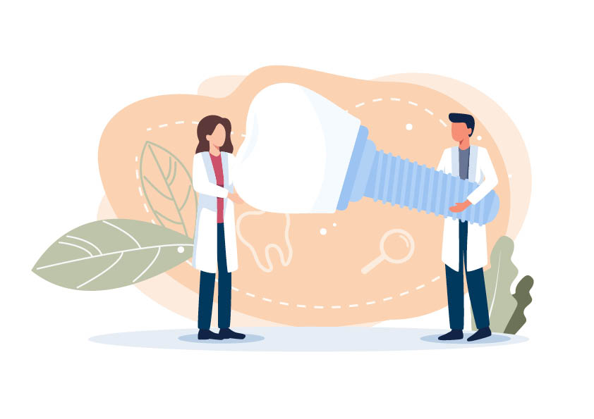 Wie funktioniert ein Implantat?